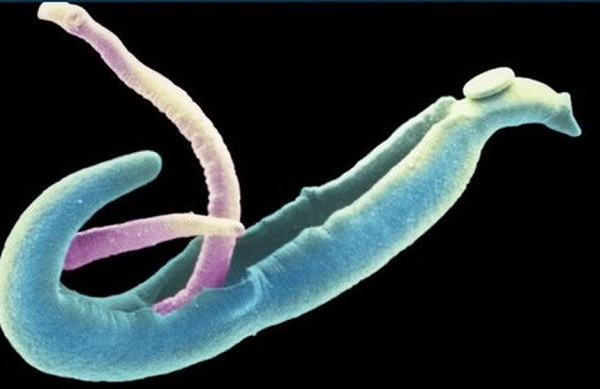 What is schistosomiasis?